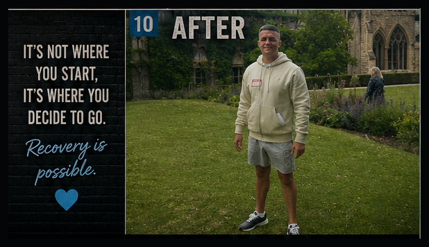 Page 11: 10 · After — Recovery Is Possible